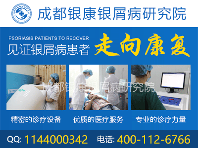 治疗脓疱型牛皮癣要注意什么