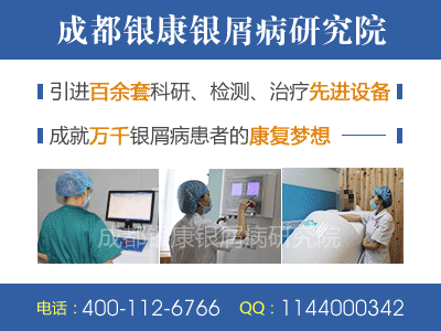 牛皮癣的护理方法有哪些