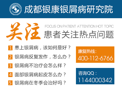 牛皮癣患者喝茶好吗?