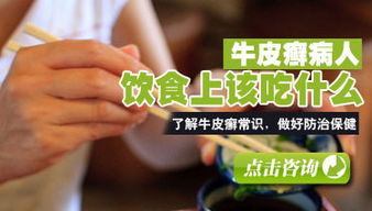 牛皮癣的危害是什么