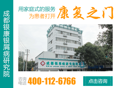牛皮癣需要什么检查
