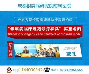  成都银屑病医院找戴礼专