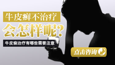 怎么让牛皮癣快点好