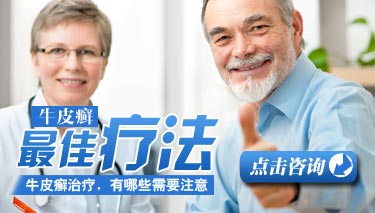 患上牛皮癣怎么办