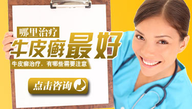 如何治疗牛皮癣较好